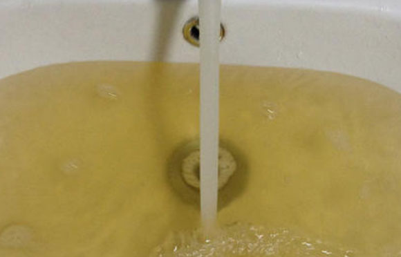 厨房净水器要不要装?如果出现这6种情况那是非装不可!